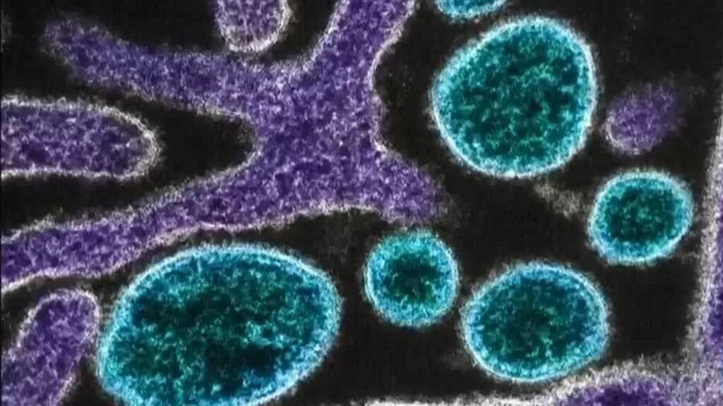 Alerta en Asia por virus Nipah: ¿Qué es y por qué preocupa?