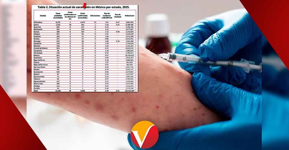 Alerta por brote de sarampión en México: más de 5 mil casos confirmados y 24 muertes