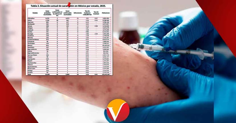 Alerta por brote de sarampión en México: más de 5 mil casos confirmados y 24 muertes