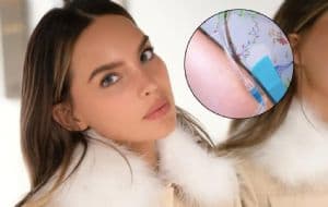 Belinda genera preocupación tras publicar foto recibiendo un tratamiento, ¿qué le pasó?