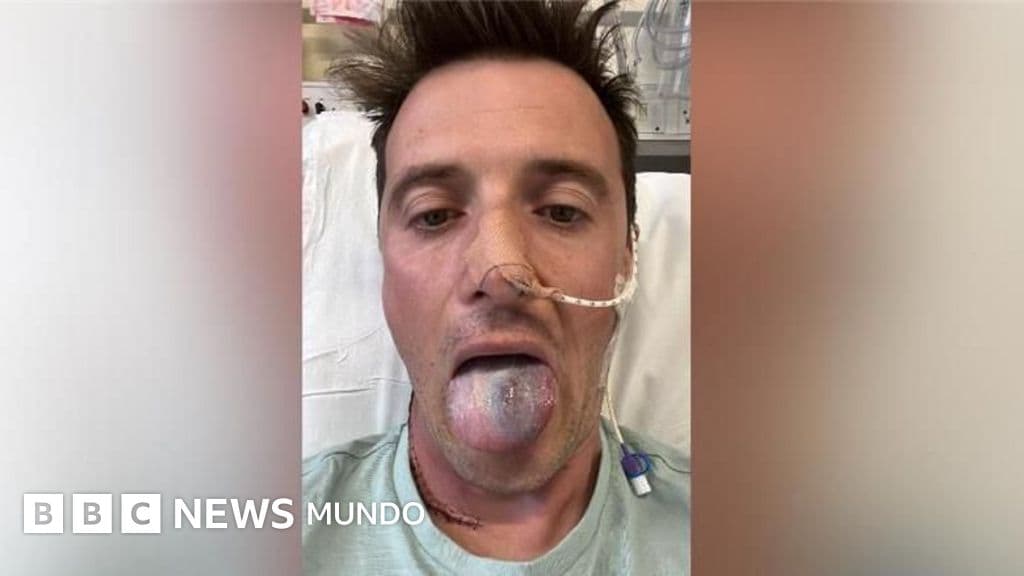 Casi pierdo la lengua por un cáncer y ahora alerto a otros hombres sobre el riesgo del virus del papiloma humano