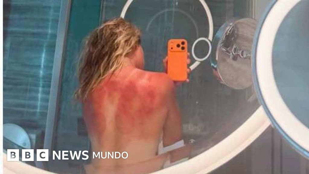 "El sol de Australia no es broma": la foto de una tenista mexicana que muestra el riesgo en el país con las tasas de cáncer de piel más altas del mundo