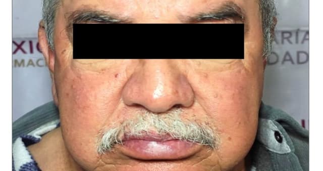 Juez da prisión preventiva al padre de "El Tortas", exlíder de la Anti Unión Tepito