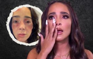 Manelyk reaparece en redes con moretones y heridas, ¿qué pasó con la influencer?