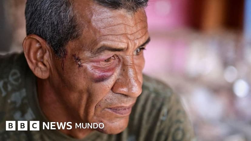 "Nunca pensé que me iban a atacar a mí": los sobrevivientes del ataque con misil al Bloque 12, el edificio donde murió una mujer por los bombardeos de EE.UU. en Venezuela