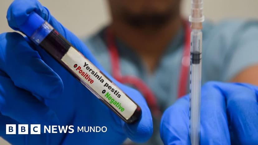 Qué es y cómo se propaga la peste neumónica que se estudia en el laboratorio de Siberia en el que falleció una trabajadora