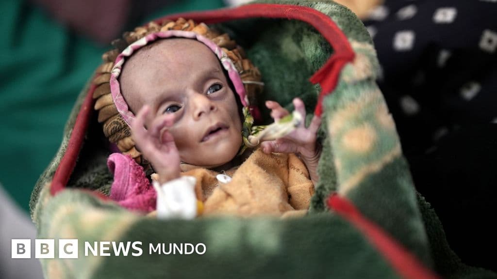Raghad y Raad, los gemelos que luchan por sobrevivir a la crisis humanitaria en Yemen.