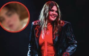 ¿Yuridia se quemó el rostro? este es su estado de salud tras pedir ayuda en redes sociales | VIDEO